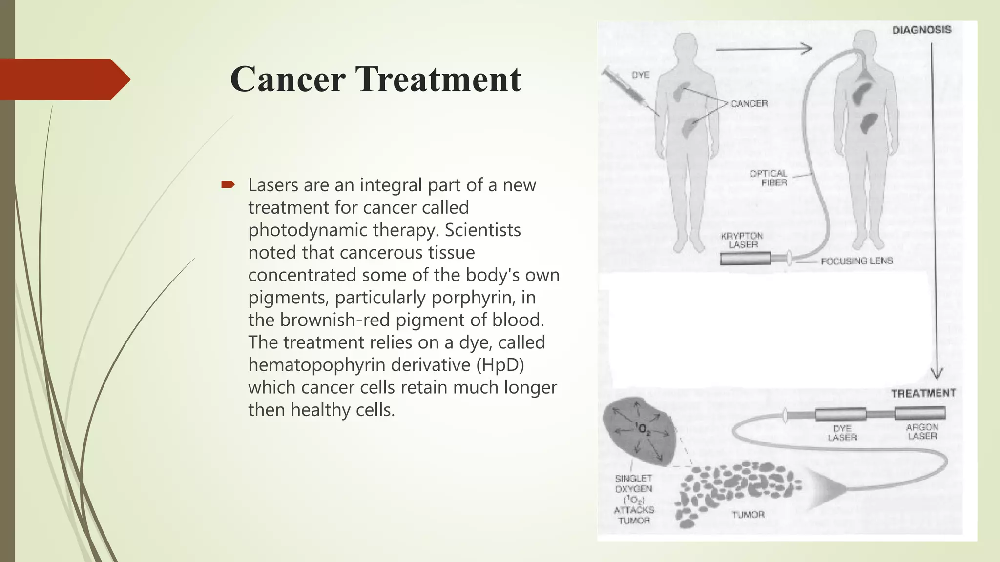 Cancer Treatment
 Lasers are an integral part of a new
treatment for cancer called
photodynamic therapy. Scientists
noted that cancerous tissue
concentrated some of the body's own
pigments, particularly porphyrin, in
the brownish-red pigment of blood.
The treatment relies on a dye, called
hematopophyrin derivative (HpD)
which cancer cells retain much longer
then healthy cells.
 