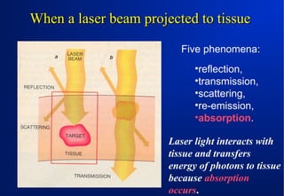 When a laser beam projected to tissue
Five phenomena:
•reflection,
•transmission,
•scattering,
•re-emission,
•absorption.
Laser light interacts with
tissue and transfers
energy of photons to tissue
because absorption
occurs.

 