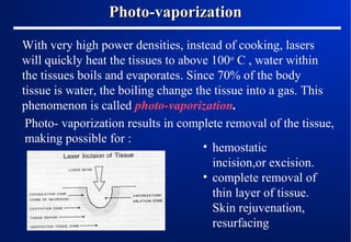 Photo-vaporization
With very high power densities, instead of cooking, lasers
will quickly heat the tissues to above 100o C , water within
the tissues boils and evaporates. Since 70% of the body
tissue is water, the boiling change the tissue into a gas. This
phenomenon is called photo-vaporization.
Photo- vaporization results in complete removal of the tissue,
making possible for :
• hemostatic
incision,or excision.
• complete removal of
thin layer of tissue.
Skin rejuvenation,
resurfacing

 