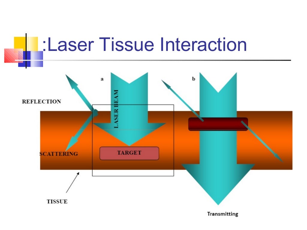 Laser applications. Presentation powerpoint laser ablation. steel ablation. laser cutting light heat affected zone. laser meaning.