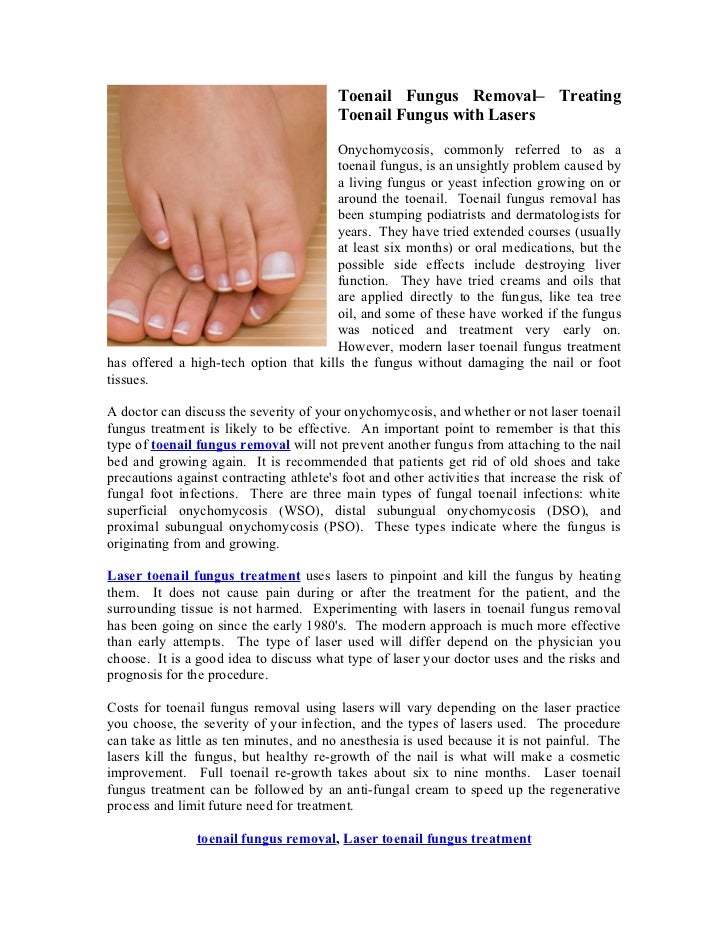 Toenail Fungus Removal Treating Toenail Fungus with Lasers