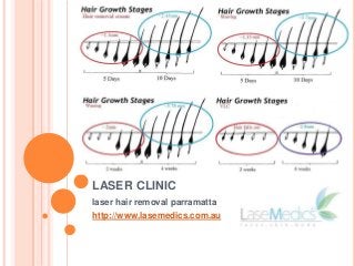 LASER CLINIC
laser hair removal parramatta
http://www.lasemedics.com.au

 