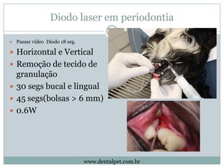 Diodo laser em periodontia

   Passar vídeo Diodo 18 seg.

 Horizontal e Vertical
 Remoção de tecido de
  granulação
 ...
