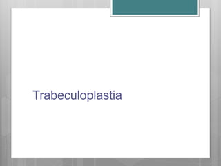 Trabeculoplastia
 