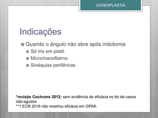 Indicações
 Quando o ângulo não abre após iridotomia
 Sd íris em platô
 Micro/nanoftalmo
 Sinéquias periféricas
GONIOPLASTIA
*revisão Cochrane 2012: sem evidência de eficácia no tto de casos
não-agudos
**1 ECR 2016 não mostrou eficácia em GPAA
 