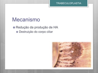 Mecanismo
 Redução da produção de HA
 Destruição do corpo ciliar
TRABECULOPLASTIA
 