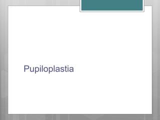Pupiloplastia
 