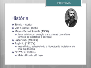 História
 Tomia = cortar
 Von Graefe (1856)
 Meyer-Schwickerath (1956)
 furar a íris com energia da luz (mas com dano
térmico de cristalino e córnea)
 Laser rubi (1960’s)
 Argônio (1970’s)
 uso clínico, substituindo a iridectomia incisional no
final da década
 Nd:YAG (1980’s)
 Mais utilizado até hoje
IRIDOTOMIA
 