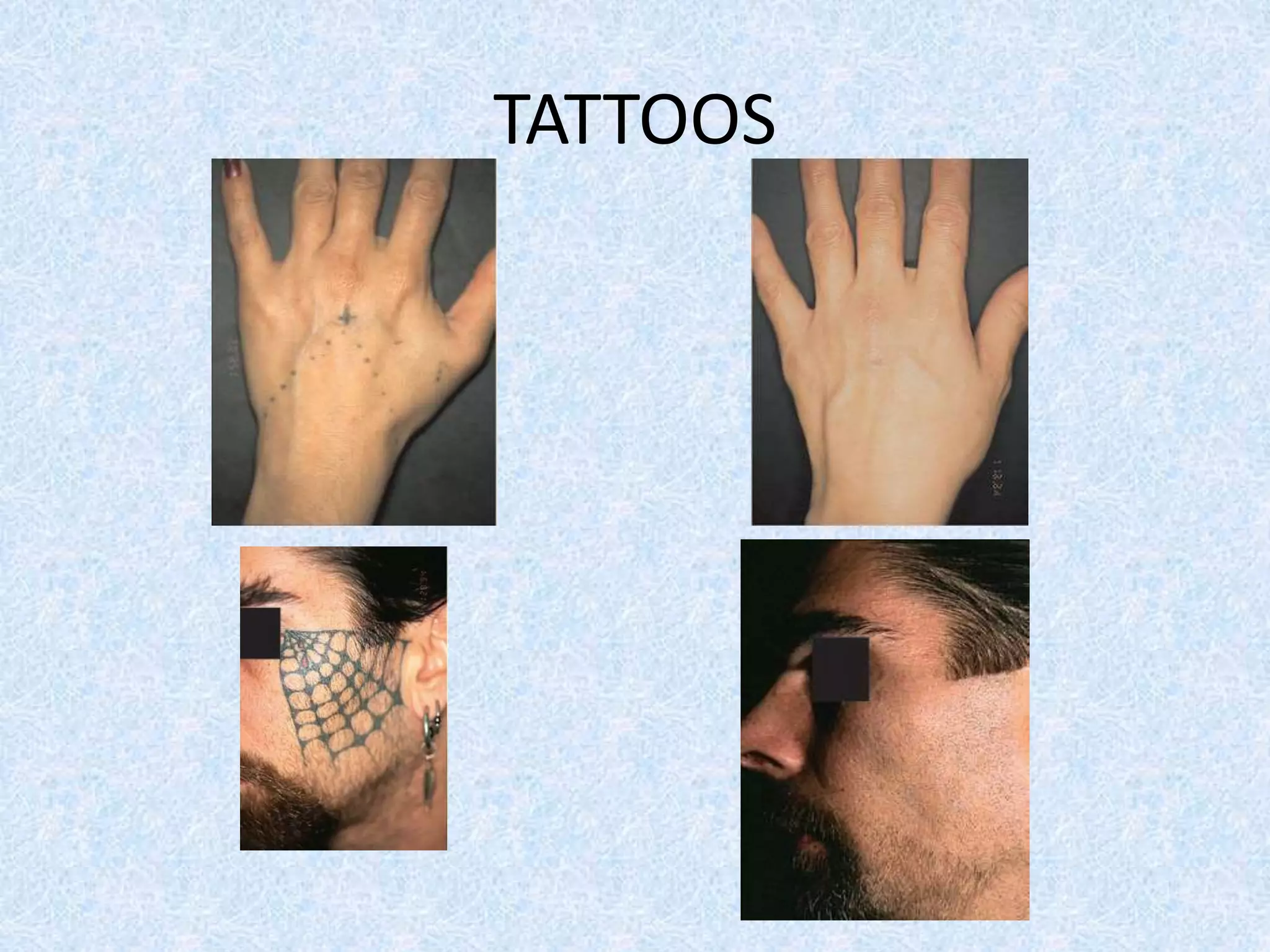 TATTOOS 
 