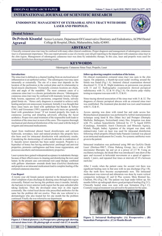 ORIGINAL RESEARCH PAPER
ENDODONTIC MANAGEMENT OF EXTRAORAL SINUS TRACT WITH DIODE
LASER AND PROPOLIS.
Dr.Pritesh Kisanlal
Agrawal
Senior Lecturer, Department Of Conservative Dentistry and Endodontics, ACPM Dental
College&Hospital,Dhule,Maharashtra,India.424001.
ABSTRACT
Clinically extraoral sinus tract may be confused with many other clinical conditions. Proper diagnosis and management of odontogenic cutaneous
tract is of paramount importance. This case report presents a case of a twenty year old girl reporting to the department with cutaneous sinus tract in
the chin region. Management of odontogenic cutaneous tract was done by endodontic therapy. In this case, laser and propolis were used for
intracanaldisinfectionshowing promisingresults.
KEYWORDS
Odontogenic Cutaneous Sinus Tract, Propolis, Laser
Introduction:
The sinus tract is deﬁned as a channel leading from an enclosed area of
1
inﬂammation to an epithelial surface. The odontogenic tract may open
intraorally or extraorally. The site of a sinus tract depends on the
location of the perforation in the cortical plate and its relationship to
2
facial-muscle attachments. Extraorally common locations are cheek,
1
chin and angle of the mandible. The most common cause of a
3
cutaneous sinus tract is a chronic periradicular abscess. Odontogenic
cutaneous sinus tract may be confused with traumatic lesions, foreign
body lesions, squamous cell carcinoma, congenital ﬁstula, salivary
2
gland ﬁstula etc. Hence early diagnosis is essential to achieve early
healing and prevent unnecessary treatment. Initially it was thought that
these sinus tracts are lined with epithelium but Bender & Seltzer
(1961) and Grossman (1981) reported that such tracts are generally
4
lined with granulation tissue. If not treated properly this leads to
cutaneous scarring and dimpling adversely affecting the facial
aesthetics. Proper root canal treatment of the responsible teeth leads to
resolution of the sinus tract in most of the cases.This requires thorough
mechanical and chemical disinfection of the root canal with the help of
irrigantsandintracanalmedicaments.
Apart from traditional phenol based disinfectants and calcium
hydroxide, nowadays, laser and natural products like propolis have
also been used for intracanal disinfection with satisfactory results.
Considering the shortcomings of calcium hydroxide in eradication of
E. faecalis newer materials has been under research. Propolis is a
byproduct of honey bee having antibacterial ,antifungal and antiviral
properties, promotes cartilaginous and bone tissue regeneration, and
5
possesses anestheticandimmunomodulatoryproperties.
Lasersystemshavegainedwidespreadacceptanceinendodontictherapy
because of their effectiveness in cleaning and disinfecting the root canal
lumen. In the present case conventional root canal therapy combined
with gallium- aluminum- arsenide diode laser (GaAlAs) disinfection
and propolis as an intracanal medicament lead to complete healing of the
extraoralcutaneoussinustract.
Case Report
A twenty year old female patient reported to the department with a
chief complaint of pus discharge & draining sinus through chin region
extraorally. Patient was having this problem since 6 months. Initially
she had pain in lower anterior tooth region but the pain subsided after
taking medicine. Then she developed sinus tract in chin region
extraorally. She visited local doctor who prescribed antibiotics for the
same but the problem did not resolve. Then she was referred to a
dermatologist who also treated her for one month but the problem
continued.Finallyshe was referredtoourdepartment.
Figure.1: Clinical pictures: (A) Preoperative photograph showing
extraoral sinus tract. (B) photograph at second visit (C) 6 months
followup showing completeresolutionof thelesion.
On clinical examination extraoral sinus tract was seen in the chin
region. On palpation, a thumb-tip-sized nodal swelling around the
ﬁstula was found (Fig.1 A). Intraoral clinical examination showed
discolored 31, 32 & 41. Slight tenderness on percussion was present
with 31 and 32. Radiographic examination showed periapical
radiolucency with 31, 32 & 41 (Fig.2 A). On electric pulp vitality
testingnoresponsewas seenwith31, 32 &41.
Sinus tracing showed association of the sinus tract with 31 & 32. The
diagnosis of chronic periapical abscess with an extraoral sinus tract
was established. The treatment plan decided was root canal treatment
with31, 32&41.
Access opening was done with round bur and endo access bur.
Biomechanical preparation was performed by hybrid instrumentation
technique using hand K ﬁles (Mani Inc) and Protaper (Dentsply
Maillefer, Ballaigues, Switzerland) rotary ﬁles. Irrigation was done
with 5% sodium hypochlorite followed by 17 % liquid EDTA
(Canalarge, Ammdent; Amrit Chemicals and Minerals Agency,
Mohali, Punjab, India). Agitation of the irrigant was done with
endoactivator. Later on laser was used for intracanal disinfection
following which propolis (Hitech India Naturals Limited) was placed
as an intracanal medicament for 2 weeks. No systemic antibiotics were
giventothepatient.
Intracanal irradiation was performed using 980 nm GaAlAs Diode
Laser (Denlase-980/7, China Daheng Group, Inc.) with a 200
micrometer ﬁberoptic tip and set at a power of 2.5 W. Using an
oscillatory technique, the diode ﬁber was introduced 1 mm short of the
apex and recessed in helicoidal movements at a speed of approxi-
mately 1 mm/s, and repeated four times at intervals of 10 s between
6
eachone.
After 2 weeks when the patient came for second visit there was
signiﬁcant healing seen in that area with no pus discharge (Fig.1 B).
Also the teeth have become asymptomatic now. The intracanal
medicament was removed and obturation was done by warm vertical
compaction technique (E and Q Plus system; Meta Biomed Inc,
Chalfont, PA) (Fig.2 B). The patient was kept under follow up. Six
months follow up radiograph shows good periapical healing (Fig.2 C).
Clinically healed sinus was seen with scar formation (Fig.1 C).
Cosmeticsurgicaltreatmentwas advisedtothepatientforthesame.
Figure 2. Intraoral Radiographs: (A) Preoperative ; (B)
ImmediatePostoperative;(C) 6-Months Recall.
INTERNATIONAL JOURNAL OF SCIENTIFIC RESEARCH
Dental Science
22 International Journal of Scientiﬁc Research
Volume-7 | Issue-4 | April-2018 | PRINT ISSN No 2277 - 8179
 