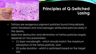 Principles of Q-Switched
Lasing
• Tattoos are exogenous pigment particles found intracellularly
within fibroblasts and macrophages distributed perivascularly in
the dermis.
• Selective destruction and elimination of tattoo particles largely
depends on two parameters:
• (1) laser wavelength - which should match the maximum
absorption of the tattoo particle, and
• (2) pulse duration - which is optimized based on the target
size.
 
