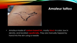 Amateur tattoo
• Amateur-made of carbon-based ink, mostly black in color, low in
density, and located superficially. They are manually tapped by
hand into the skin using a needle
 