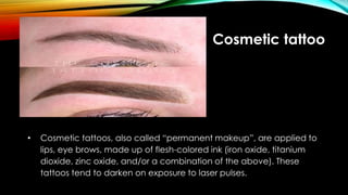 Cosmetic tattoo
• Cosmetic tattoos, also called “permanent makeup”, are applied to
lips, eye brows, made up of flesh-colored ink (iron oxide, titanium
dioxide, zinc oxide, and/or a combination of the above). These
tattoos tend to darken on exposure to laser pulses.
 