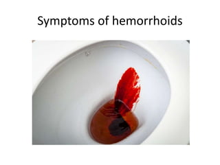 Symptoms of hemorrhoids
 
