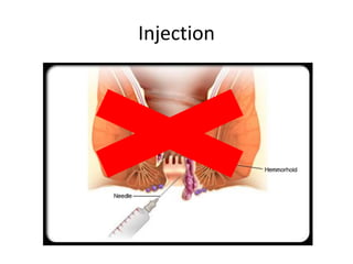 Injection
 