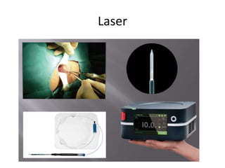 Laser
 
