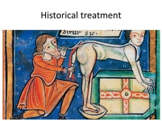Historical treatment
 