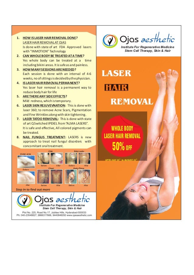 Laser hair removal procedures hyderabad