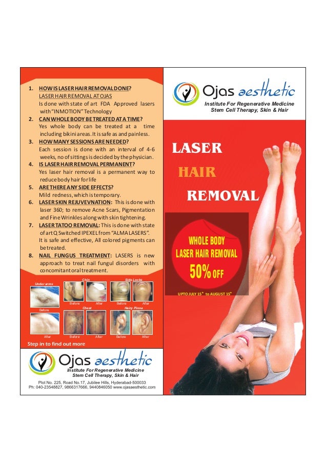 Laser hair removal procedures hyderabad