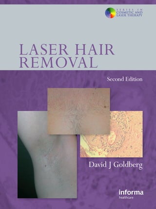 LASER HAIR 
REMOVAL 
Second Edition 
David J Goldberg 
 