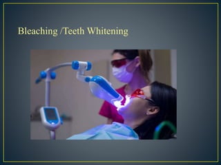 Bleaching /Teeth Whitening