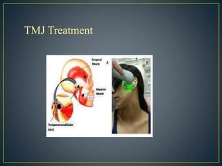 TMJ Treatment