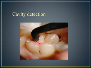 Cavity detection