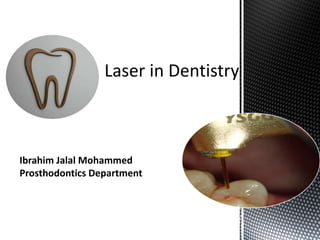 Laser in Dentistry
Ibrahim Jalal Mohammed
Prosthodontics Department
 
