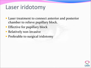 Laser iridotomy 
 Laser treatment to connect anterior and posterior 
chamber to relieve pupillary block. 
 Effective for pupillary block 
 Relatively non invasive 
 Preferable to surgical iridotomy 
 
