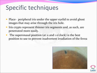 Specific techniques 
 Place- peripheral iris under the upper eyelid to avoid ghost 
images that may arise through the iris hole. 
 Iris crypts represent thinner iris segments and, as such, are 
penetrated more easily. 
 The superonasal position (at 11 and 1 o’clock) is the best 
position to use to prevent inadvertent irradiation of the fovea 
 