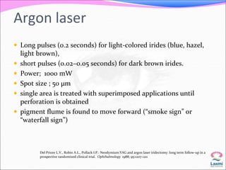 Argon laser 
 Long pulses (0.2 seconds) for light-colored irides (blue, hazel, 
light brown), 
 short pulses (0.02–0.05 seconds) for dark brown irides. 
 Power; 1000 mW 
 Spot size ; 50 μm 
 single area is treated with superimposed applications until 
perforation is obtained 
 pigment flume is found to move forward (“smoke sign” or 
“waterfall sign”) 
Del Priore L.V., Robin A.L., Pollack I.P.: Neodymium:YAG and argon laser iridectomy: long term follow-up in a 
prospective randomized clinical trial. Ophthalmology 1988; 95:1207-1211 
 