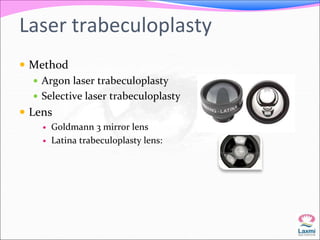 Laser trabeculoplasty 
 Method 
 Argon laser trabeculoplasty 
 Selective laser trabeculoplasty 
 Lens 
 Goldmann 3 mirror lens 
 Latina trabeculoplasty lens: 
 