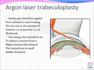 Argon laser trabeculoplasty 
 Ideally,spot should be applied 
Over schlemm’s canal avoding 
The iris root at the junction of 
Anterior 1/3 to posterior 2/3 of 
Meshwork. 
 The energy level should be set 
To induce a reaction from a 
Slight transient blanching of 
The treated area to small 
Bubble formation 
 