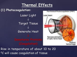 Thermal Effects
(1) Photocoagulation:
Laser Light

Target Tissue

Generate Heat

Denatures Proteins
(Coagulation)
Rise in temperature of about 10 to 20
0C will cause coagulation of tissue
 