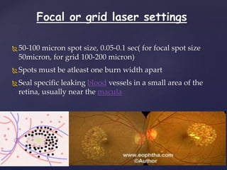 Focal or grid laser settings
50-100 micron spot size, 0.05-0.1 sec( for focal spot size
50micron, for grid 100-200 micron)
Spots must be atleast one burn width apart
Seal specific leaking blood vessels in a small area of the
retina, usually near the macula
 