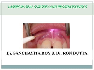 LASERSINORALSURGERYANDPROSTHODONTICS
Dr. SANCHAYITA ROY & Dr. RON DUTTA
 