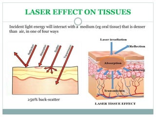 LASER EFFECT ON TISSUES
Incident light energy will interact with a medium (eg oral tissue) that is denser
than air, in one of four ways
≥50% back-scatter
 