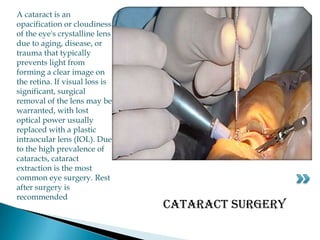 A cataract is an opacification or cloudiness of the eye's crystalline lens due to aging, disease, or trauma that typically prevents light from forming a clear image on the retina. If visual loss is significant, surgical removal of the lens may be warranted, with lost optical power usually replaced with a plastic intraocular lens (IOL). Due to the high prevalence of cataracts, cataract extraction is the most common eye surgery. Rest after surgery is recommendedCataract surgery