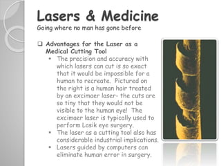 What is Laser Surgery ?
 The goal in laser eye surgery is to reshape the cornea,
changing the focal point of the eye. Ide...