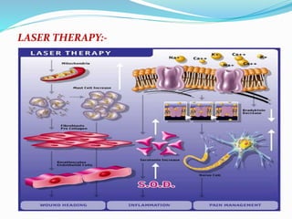 LASER THERAPY:- 
 