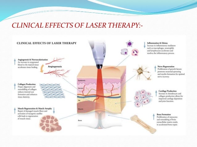 Complications And Management Of Laser Therapy – WECPU