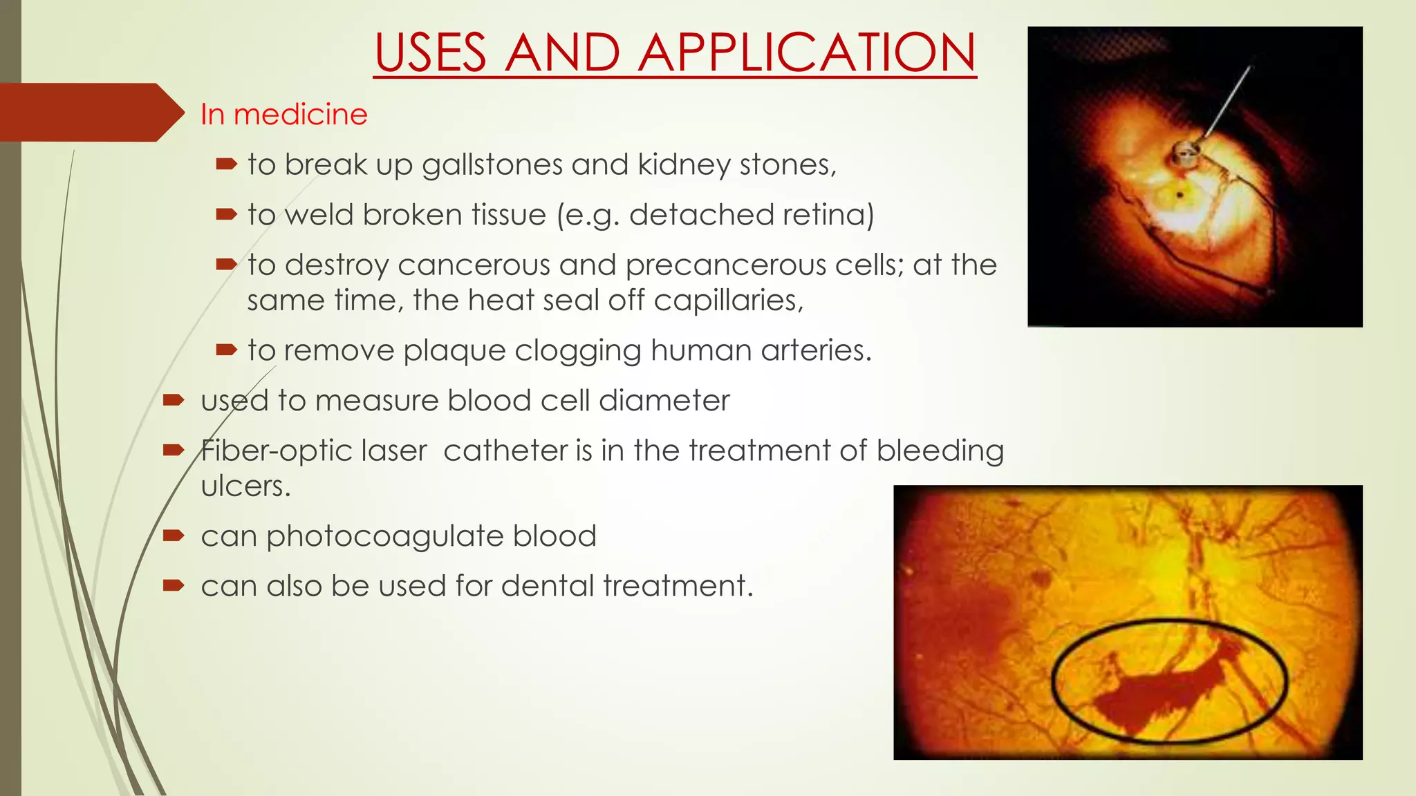 USES AND APPLICATION
 In medicine
 to break up gallstones and kidney stones,
 to weld broken tissue (e.g. detached retina)
 to destroy cancerous and precancerous cells; at the
same time, the heat seal off capillaries,
 to remove plaque clogging human arteries.
 used to measure blood cell diameter
 Fiber-optic laser catheter is in the treatment of bleeding
ulcers.
 can photocoagulate blood
 can also be used for dental treatment.
 