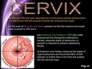  Although CIN has been described as a noninvasive surface phenomenon, 
it is well known that the process involves the endocervical crypts. 
 The work of Te Linde and others pointed out that the endocervical crypts 
were involved in CIN, but it 
was Anderson and Hartley in 1980 who really 
emphasized the therapeutic implications; 
namely, adequate depth of destruction or 
excision is required to achieve satisfactory 
results. 
 Anderson and Hartley measured the depth of 
crypt involvement and found that 99% of CIN 
extends no further than 4 mm from the surface 
into the cervical crypt. 
Page 47 
 