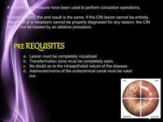 Page 50 
A number of techniques have been used to perform conization operations. 
In laser surgery, the end result is the same. If the CIN lesion cannot be entirely 
visualized or a neoplasm cannot be properly diagnosed for any reason, the CIN 
should not be treated by an ablative procedure. 
PRE REQUISITES 
a. Lesion must be completely visualized. 
b. Transformation zone must be completely seen. 
c. No doubt as to the intraepithelial nature of the disease. 
d. Adenocarcinoma of the endocervical canal must be ruled 
out. 
 
