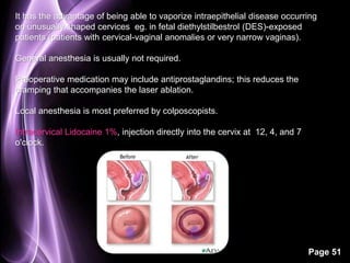 It has the advantage of being able to vaporize intraepithelial disease occurring 
on unusually shaped cervices eg. in fetal diethylstilbestrol (DES)-exposed 
patients (patients with cervical-vaginal anomalies or very narrow vaginas). 
Page 51 
General anesthesia is usually not required. 
Preoperative medication may include antiprostaglandins; this reduces the 
cramping that accompanies the laser ablation. 
Local anesthesia is most preferred by colposcopists. 
Intracervical Lidocaine 1%, injection directly into the cervix at 12, 4, and 7 
o'clock. 
 