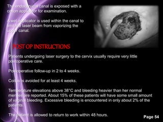 Page 54 
The endocervical canal is exposed with a 
cotton applicator for examination. 
A wet applicator is used within the canal to 
limit the laser beam from vaporizing the 
upper canal. 
POST OP INSTRUCTIONS 
Patients undergoing laser surgery to the cervix usually require very little 
postoperative care. 
Postoperative follow-up in 2 to 4 weeks. 
Coitus is avoided for at least 4 weeks. 
Temperature elevations above 38°C and bleeding heavier than her normal 
menses are reported. About 15% of these patients will have some small amount 
of vaginal bleeding. Excessive bleeding is encountered in only about 2% of the 
patients. 
The patient is allowed to return to work within 48 hours. 
 