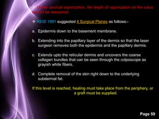  Unlike cervical vaporization, the depth of vaporization on the vulva 
cannot be measured. 
Page 59 
 REID 1991 suggested 4 Surgical Planes as follows:- 
a. Epidermis down to the basement membrane. 
b. Extending into the papillary layer of the dermis so that the laser 
surgeon removes both the epidermis and the papillary dermis. 
c. Extends upto the reticular dermis and uncovers the coarse 
collagen bundles that can be seen through the colposcope as 
grayish white fibers. 
d. Complete removal of the skin right down to the underlying 
subdermal fat. 
If this level is reached, healing must take place from the periphery, or 
a graft must be supplied. 
 