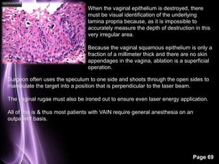 When the vaginal epithelium is destroyed, there 
must be visual identification of the underlying 
lamina propria because, as it is impossible to 
accurately measure the depth of destruction in this 
very irregular area. 
Because the vaginal squamous epithelium is only a 
fraction of a millimeter thick and there are no skin 
appendages in the vagina, ablation is a superficial 
operation. 
Surgeon often uses the speculum to one side and shoots through the open sides to 
manipulate the target into a position that is perpendicular to the laser beam. 
The vaginal rugae must also be ironed out to ensure even laser energy application. 
All of this is & thus most patients with VAIN require general anesthesia on an 
outpatient basis. 
Page 69 
 