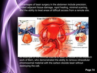 Advantages of laser surgery in the abdomen include precision, 
limited adjacent tissue damage, rapid healing, minimal scarring, 
and the ability to treat areas of difficult access from a remote site. 
An example of the minimal trauma of laser on tissue is the research 
work of Bern, who demonstrated the ability to remove intracellular 
chromosomal material with the carbon dioxide laser without 
destroying the cell. 
Page 74 
 