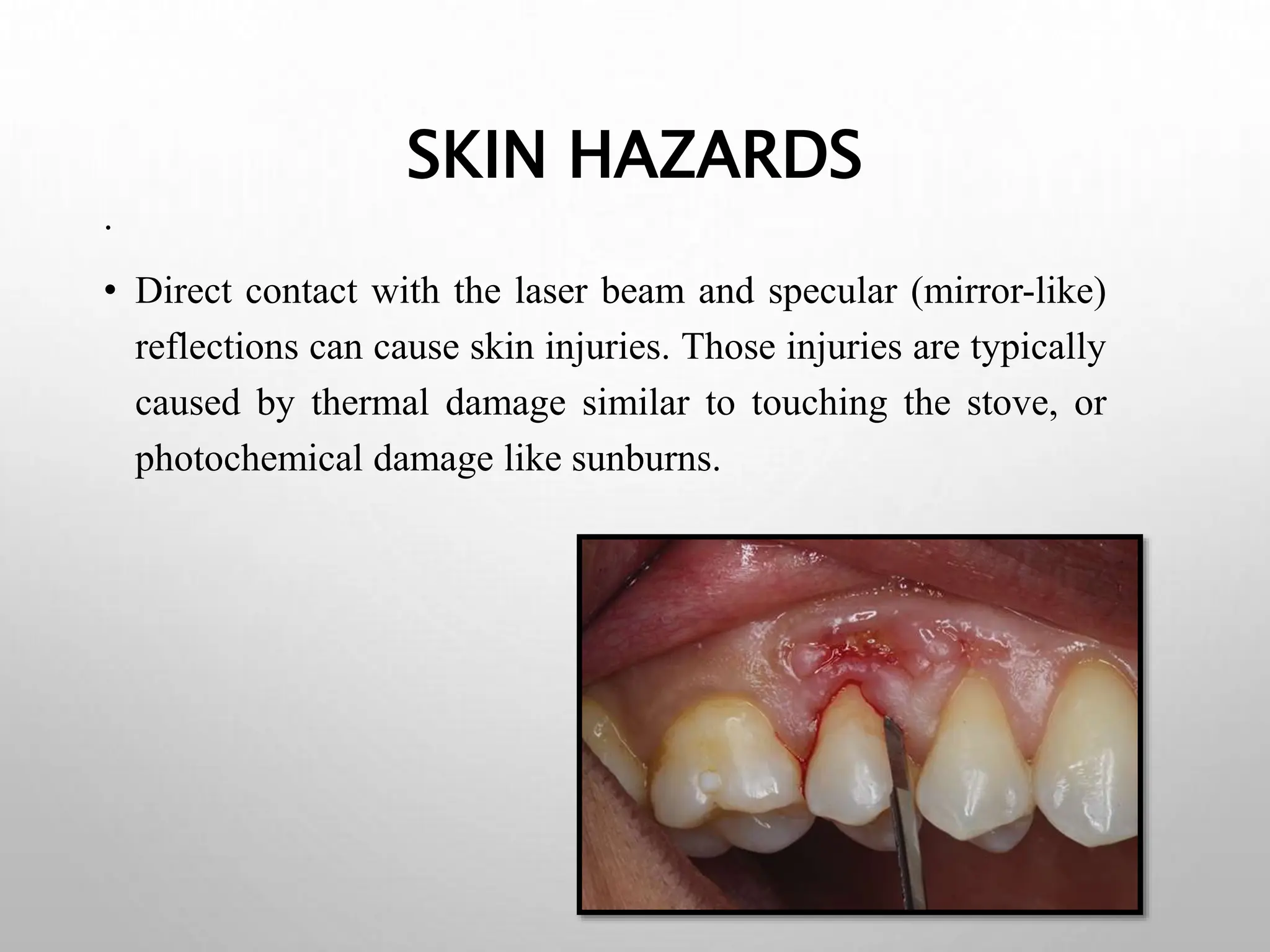 laser safety and hazards and their precautions.pptx